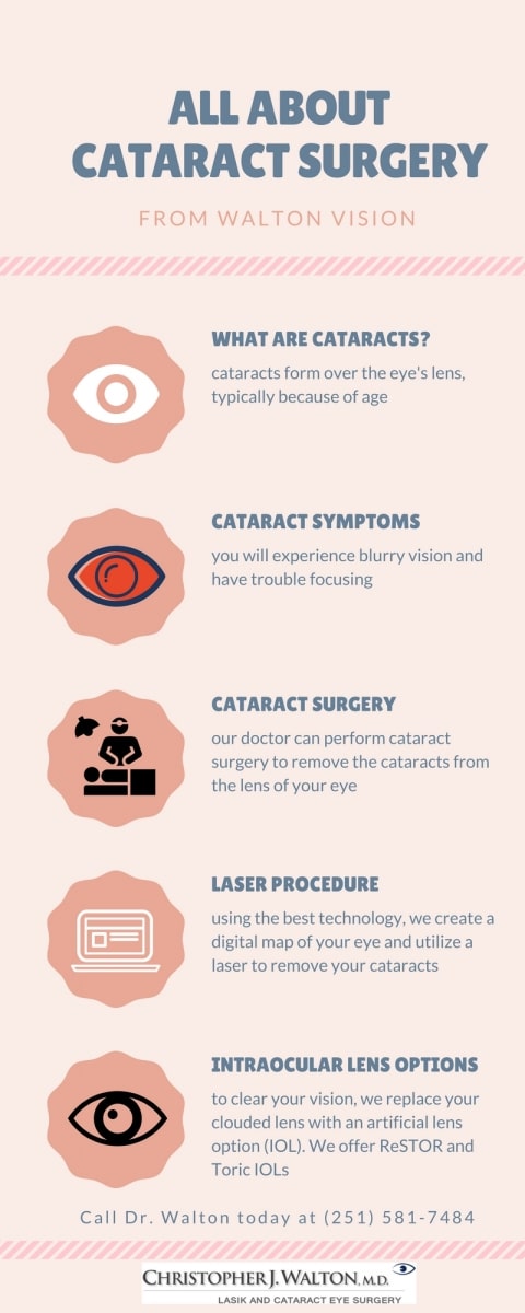 Cataract Surgery Mobile AL