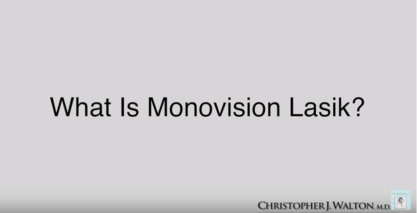 Monovision lasik on sale