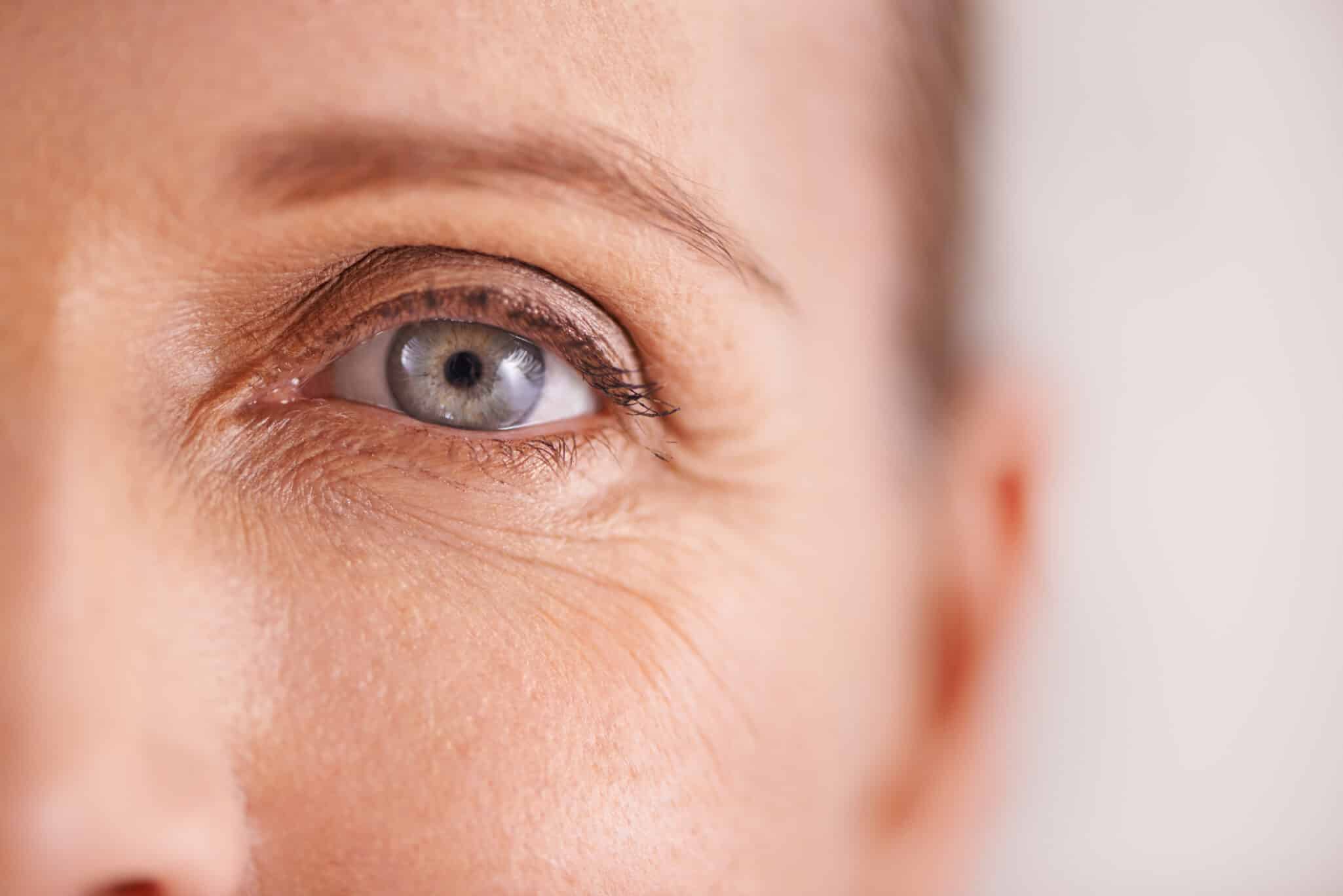 Corneal Transplant Surgery in Mobile Al